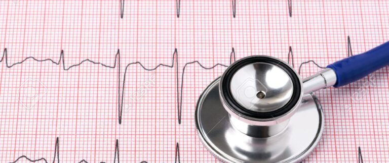 13203176-photo-of-an-electrocardiogram-ecg-or-ekg-printout-with-stethoscope